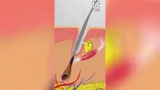 روش مصرف پک رویش مجدد مو بلکبری