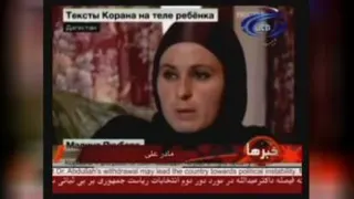 ظاهر شدن آیات قرآن روی بدن طفل(علی)