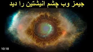 درمان درد دیسک گردن و مچ دست راست مهندس اطلسی