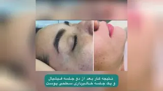 فیشیال تخصصی پوست