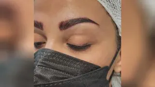 کاشت ابرو