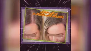 مزوتراپی ریزش مو