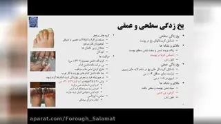 سرمازدگی و گرمازدگی