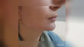 بهترین دکتر زیبایی در شیراز