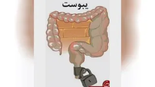 یبوست