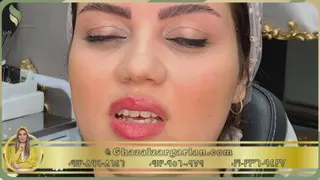 میکروبلیدینگ در غرب تهران با ماندگاری بالا