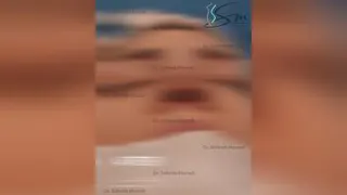 عمل زیبایی بینی