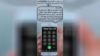 ریزش مو ( دکتر زجاجی )