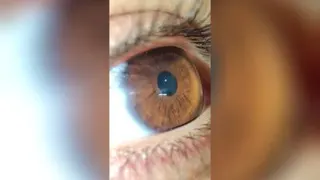 تست دوربین ماکرو شیائومی 11 تی پرو