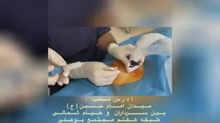 بلوک عصبی