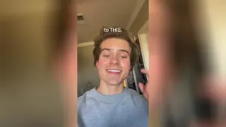 تقویت کننده مو