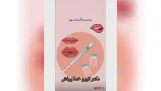 ژل لب خانم دکتر ابوطالبی