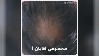 مزو تراپی خانم دکتر ابوطالبی