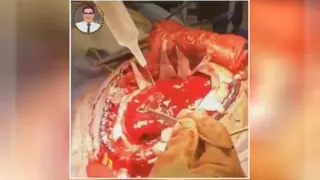 شست و شوی مغزی اینطوریه