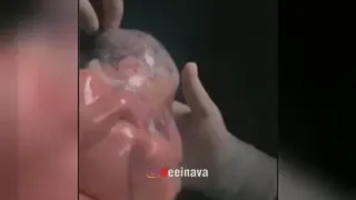 بچه بعد از به دنیا امدن