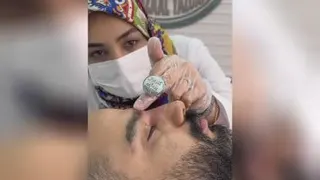 فیلر بینی به سبک دکتر یزدانی