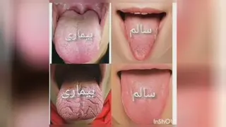 تشخیص بیماری