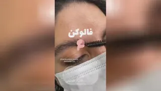 پاک کردن تتو و خالکوبی بدون آسیب به مو و پوست