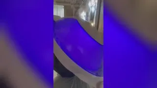 اوزون تراپی