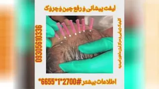 لیفت پیشانی ورفع چروک