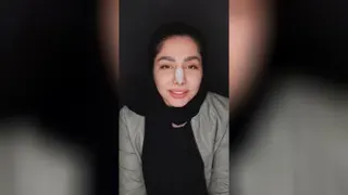 طراحی لبخند در اصفهان