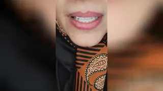 لمینت دندان در اصفهان