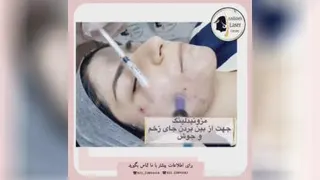 لیزر ارزان در تهران