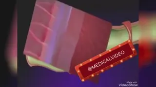 ویدئو جالب پزشکی