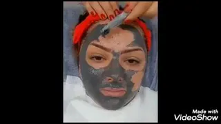 بهترین فیشال پوست در اصفهان