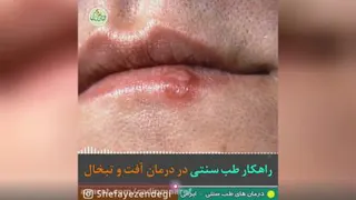 طب سنتی