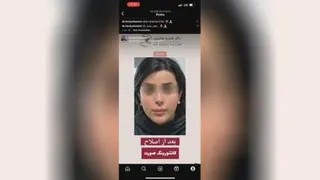 بهترین مرکز لیزر در کرمانشاه