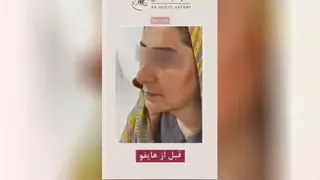 بهترین مرکز لیزر در کرج
