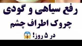 یکی از بهترین، کاربردی ترین و راحترین ماسک ها و کرم های دور چشم برای رفع سیاهی،