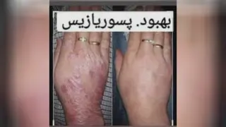 تبلیغات