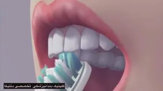 روش مسواک زدن BASS