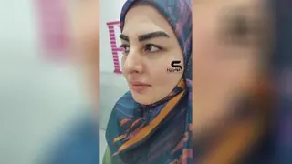 کاشت ابرو