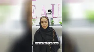 کاشت ابرو