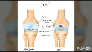 محصول درمانی آرتیکو