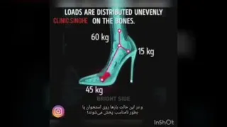 تاثیرات کفش پاشنه بلند بروی مفاصل پا