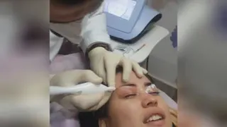 پلاسما جت پشت پلک