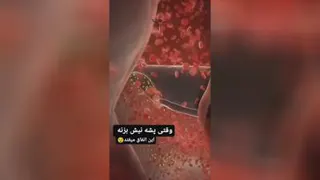 نیش زدن پشه