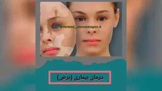 داروی مرکب ده (سید الدویه )