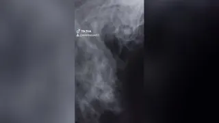 تیکه کلام