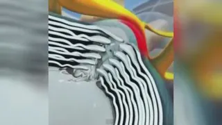 بیرون زدگی دیسک