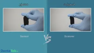 مقایسه دستگاه فسفرپلیت با سنسور RVG