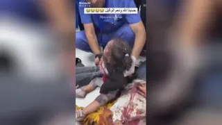 بیمارستان المعمدانی بعد از حمله صهیونیست‌ها