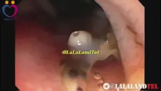 تصفیه آب سولار استار