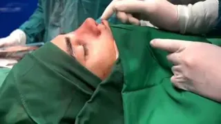 جراحی رینوپلاستی