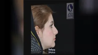 بهترین جراح پلاستیک و زیبایی در اصفهان