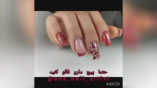 کاشت ناخن چهاردانگه